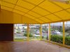 Large Canopy shade for residential home